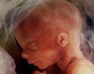 The Case Against Abortion